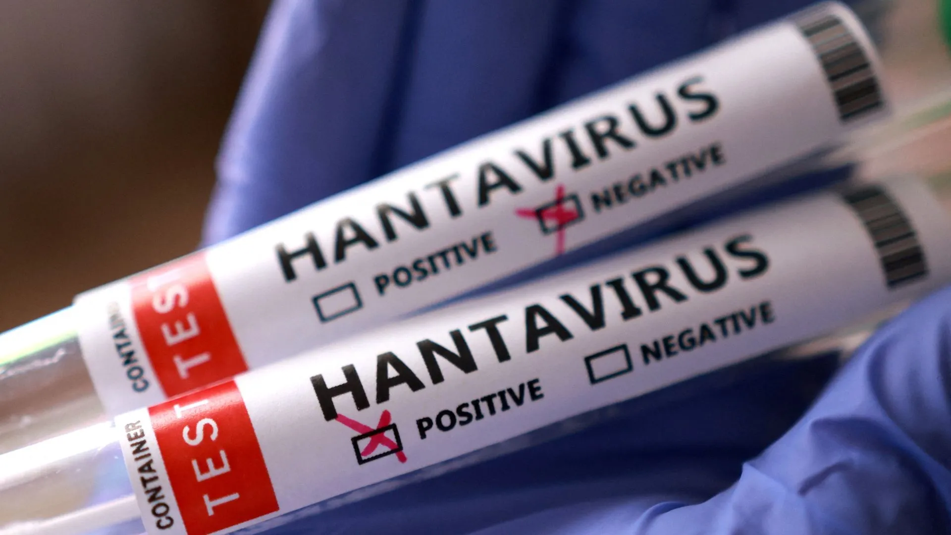 hantavirus